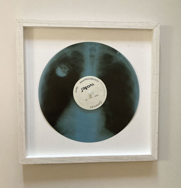 肋骨レコードの再現